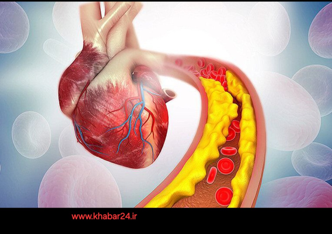 خبر۲۴ : بهترین نوشیدنی برای کاهش کلسترول خون